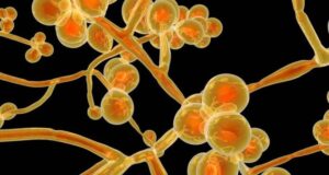 Infecções por fungo ‘Candida auris’ acende alerta de saúde nos EUA